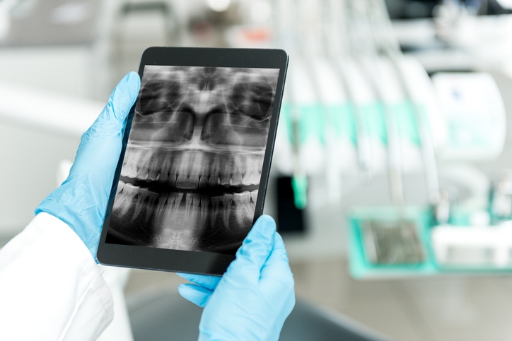 ekspertyza radiogramu dentystycznego na tablecie